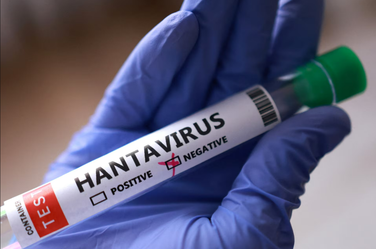 Descubren el 'punto débil' del hantavirus andino y abren la vía para posibles tratamientos