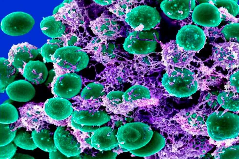 De microbios y microbiología a microbiota