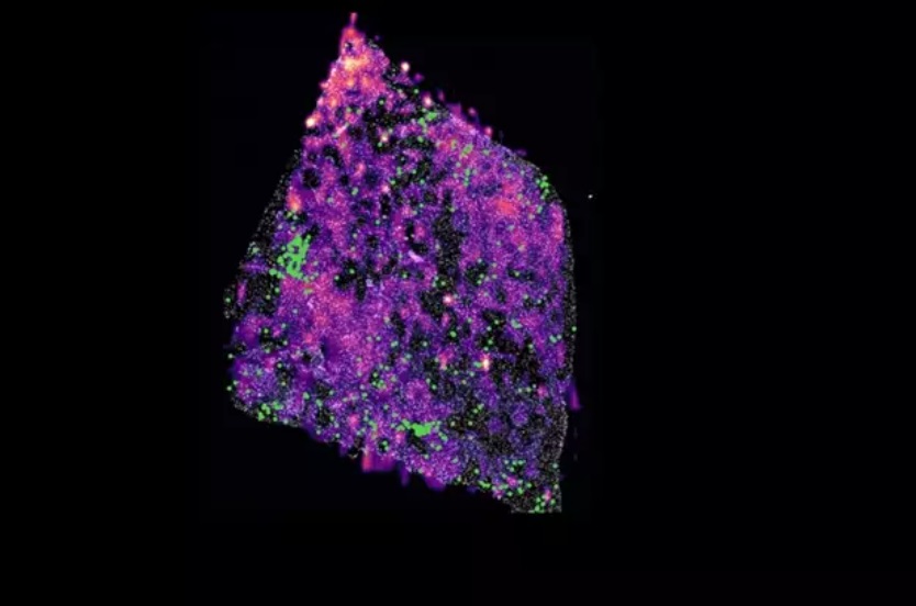 Cáncer en mujeres mayas de Yucatán, en aumento