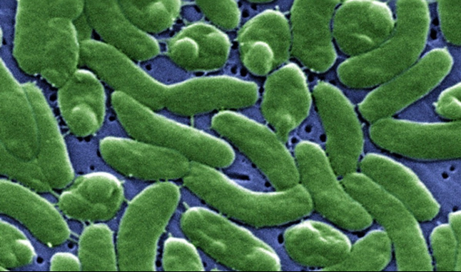 Florida confirma un muerto y 12 afectados por ''bacteria carnívora'' en el condado de Palm Beach