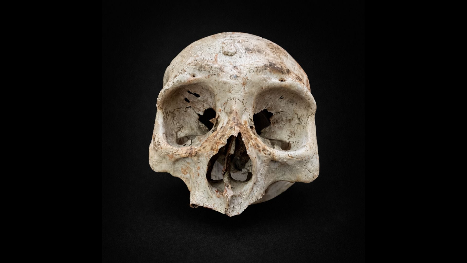 Un diente más, un diente menos