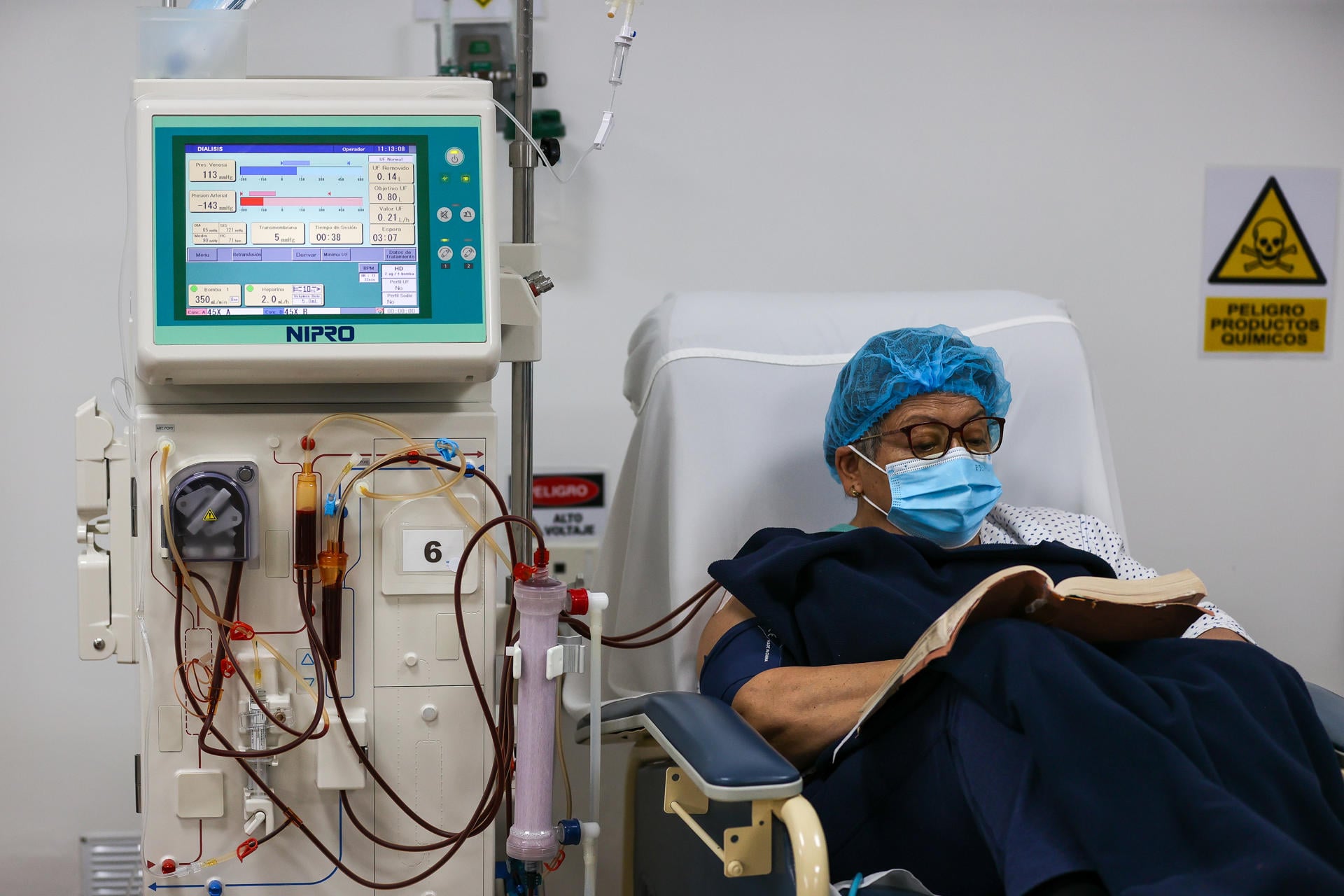 Terminar con la subrogación pega a pacientes de hemodiálisis del IMSS