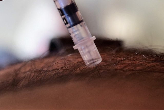 Viabilidad del sistema de salud en México, bajo amenaza