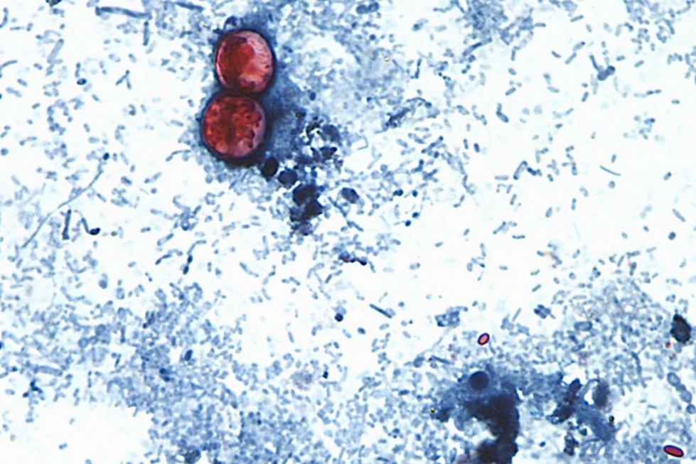EU reporta primeras dos muertes por brote de cyclospora relacionado con lechugas, en Michigan
