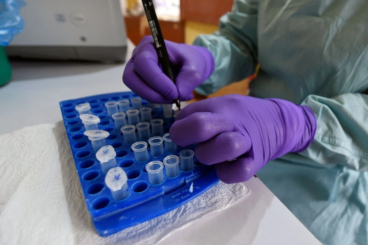 Francia reporta primera persona muerta por virus shamonda, patógeno habitual en ganado; no era transmisible en humanos