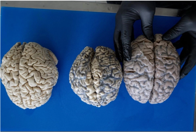Cerebros más grandes inclinaron al 90 por ciento de los humanos a ser diestros: Esto dice el estudio