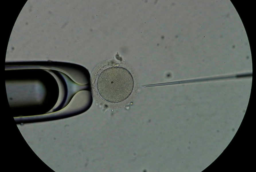 Logran un embarazo con método que recupera esperma con Inteligencia Artificial