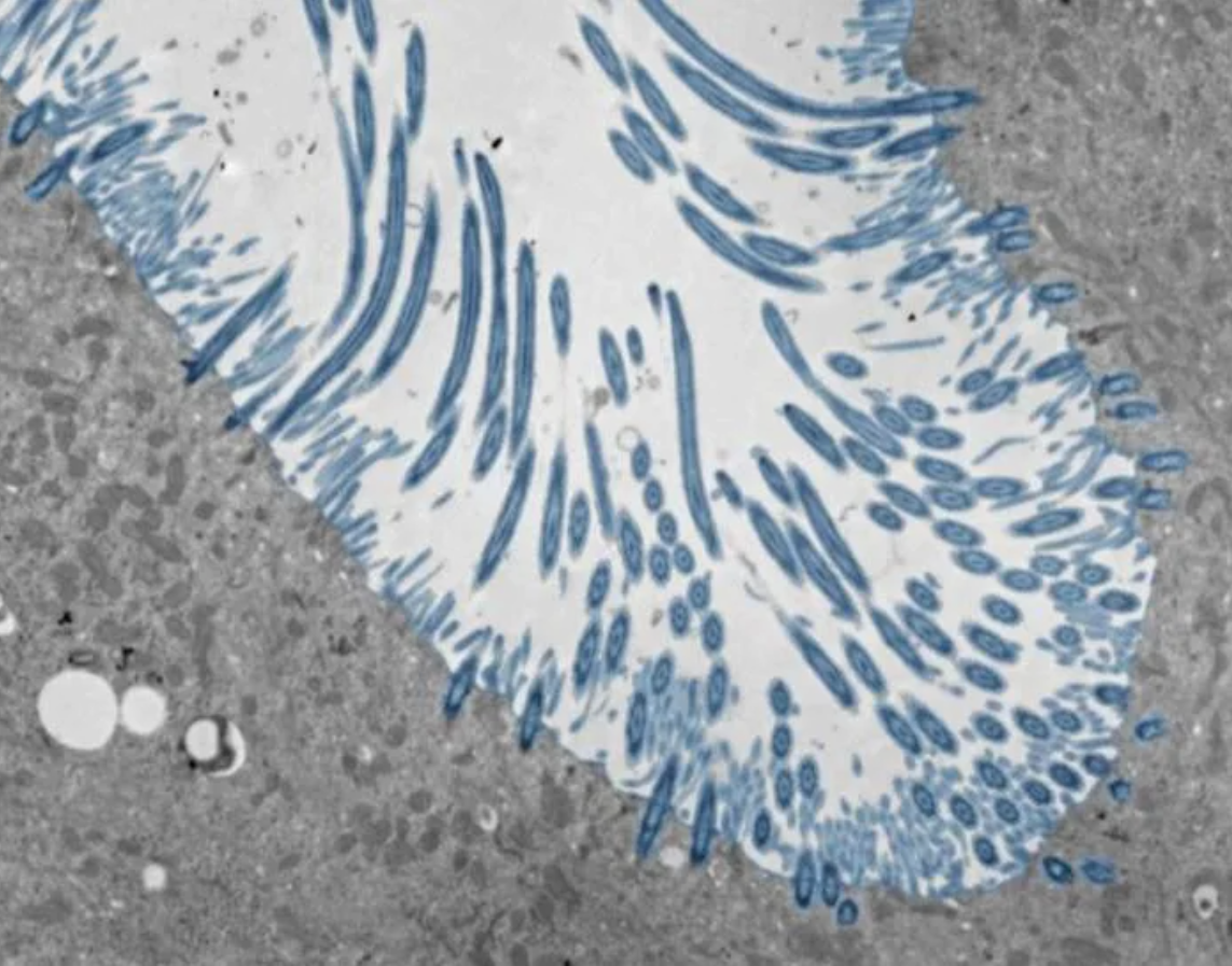 Fosas nasales nos defienden del resfriado común y fijan la gravedad de la infección: Esto dice el estudio