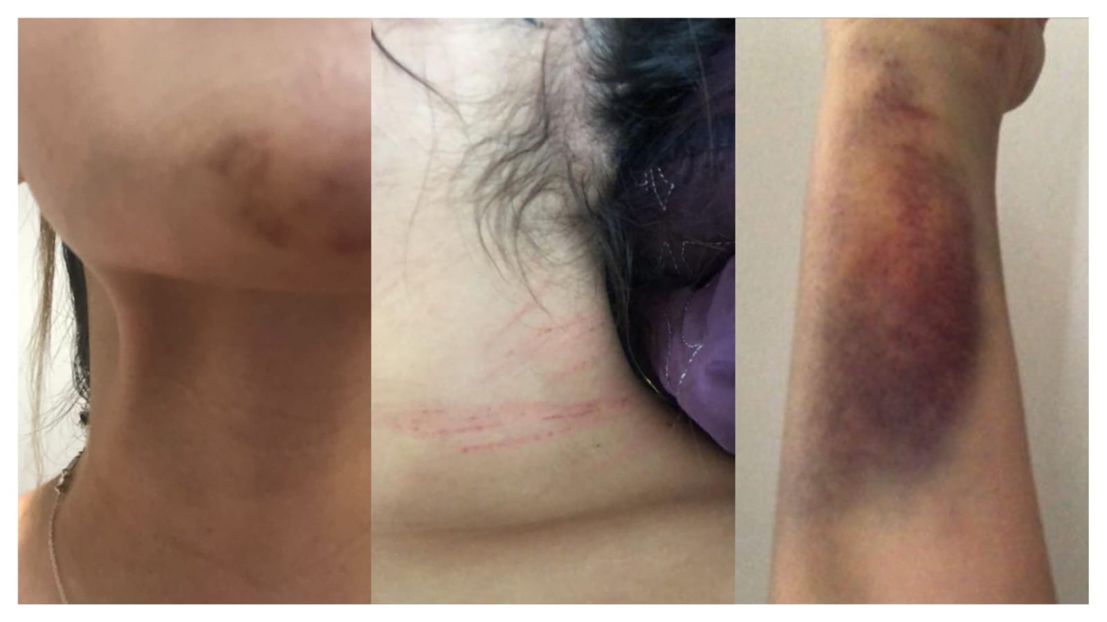 Juez libera a procesado por feminicidio agravado en grado de tentativa en Yucatán