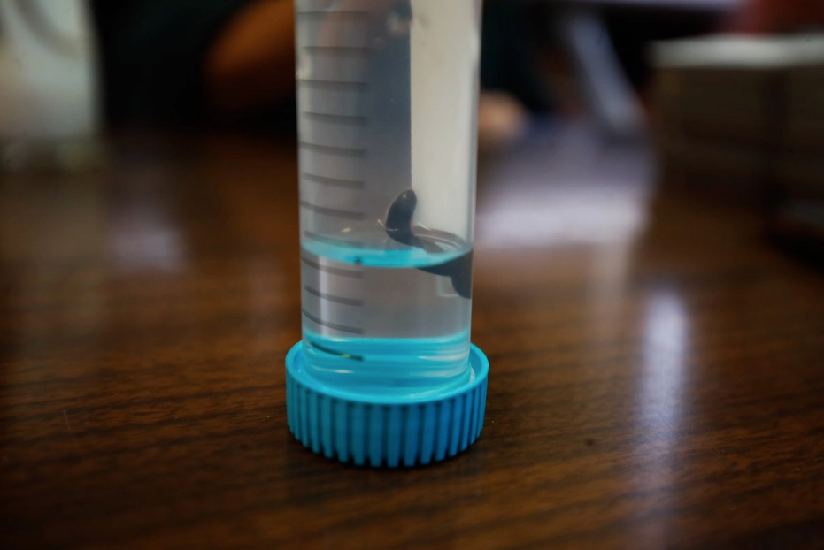 La sanguijuela, una aliada inesperada para entender el cerebro humano