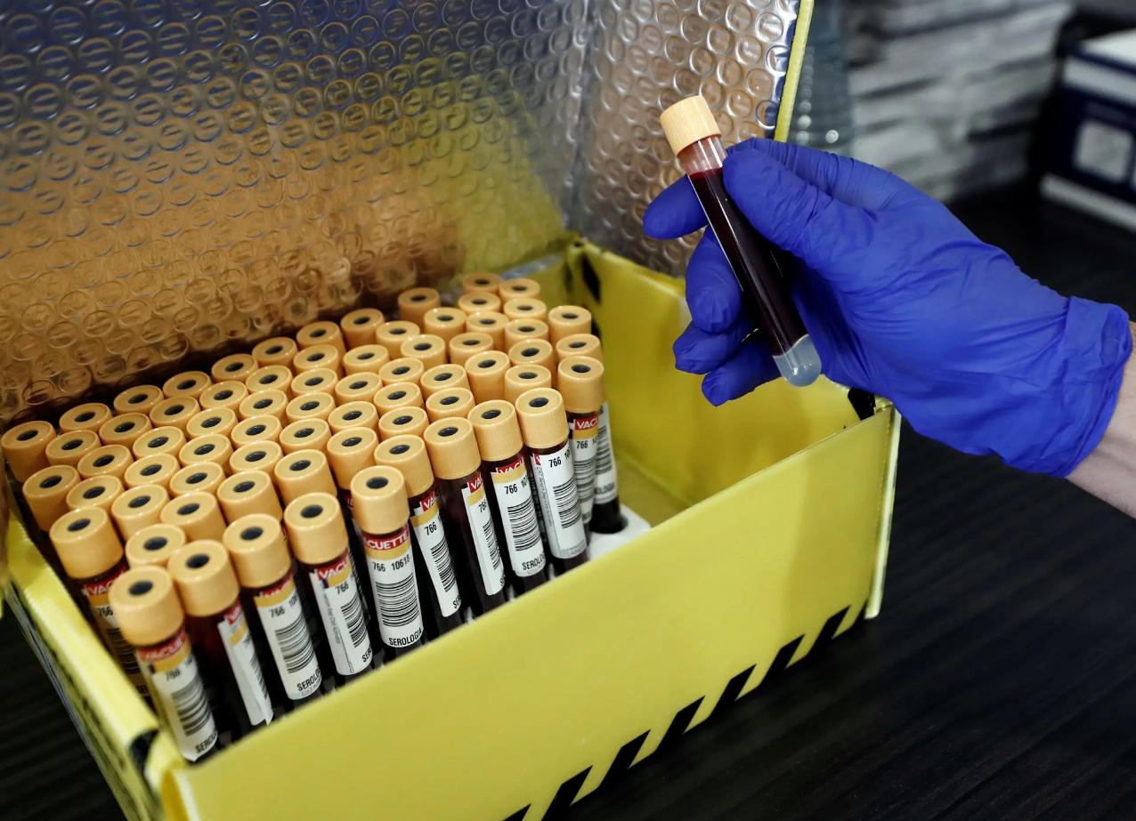 Desarrollan dispositivo portátil para detectar cáncer de pulmón con una gota de sangre