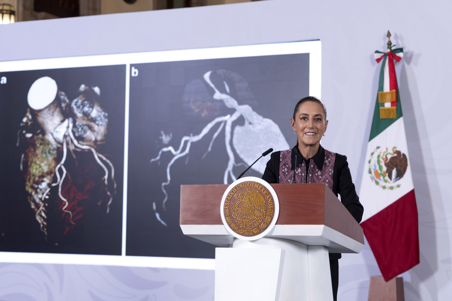 IMSS instaló 42 nuevos tomógrafos de última generación en 40 hospitales de 19 estados