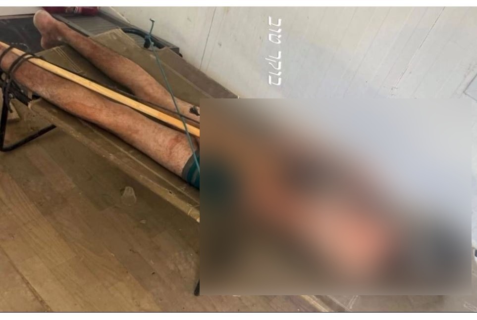 Se viraliza imagen de un palestino torturado en cárcel de Israel
